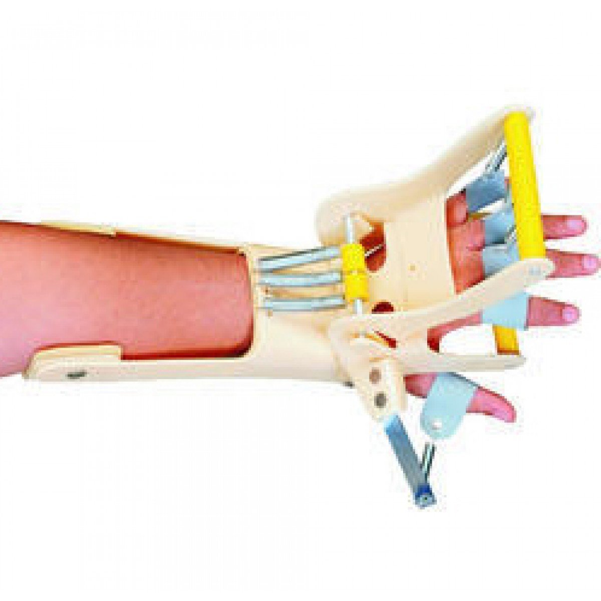 DYNA COCK UP SPLINT (With Finger Ext. Assist)